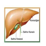 Safra Kesesi Ameliyatı