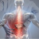 Dar Kanal Ameliyatı: Yürürken Bacak Ağrısı ve Kısalan Yürüme Mesafesinin Nedeni