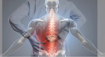 Dar Kanal Ameliyatı: Yürürken Bacak Ağrısı ve Kısalan Yürüme Mesafesinin Nedeni